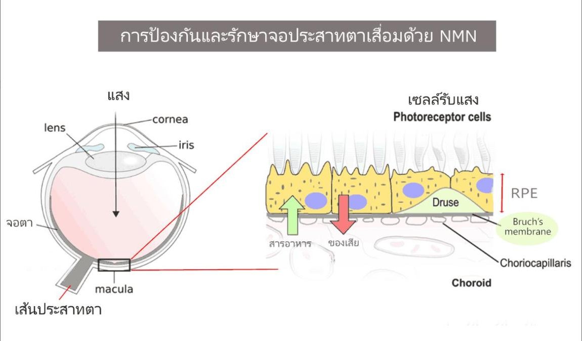 การป้องกันและรักษาจอประสาทตาเสื่อมด้วย NMN