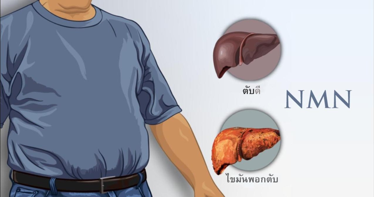 NMN กับการรักษาโรคอ้วนและโรคไขมันพอกตับ