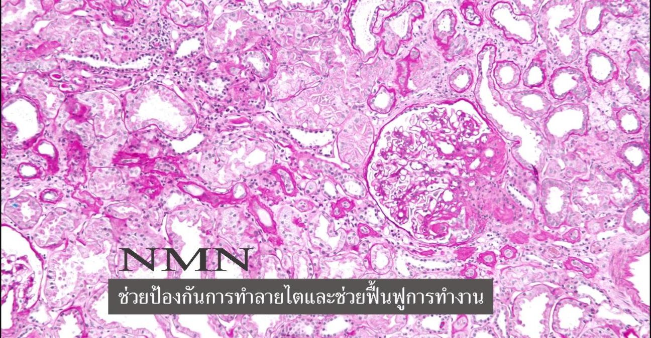 NMN ช่วยป้องกันการทำลายไตและช่วยฟื้นฟูการทำงาน