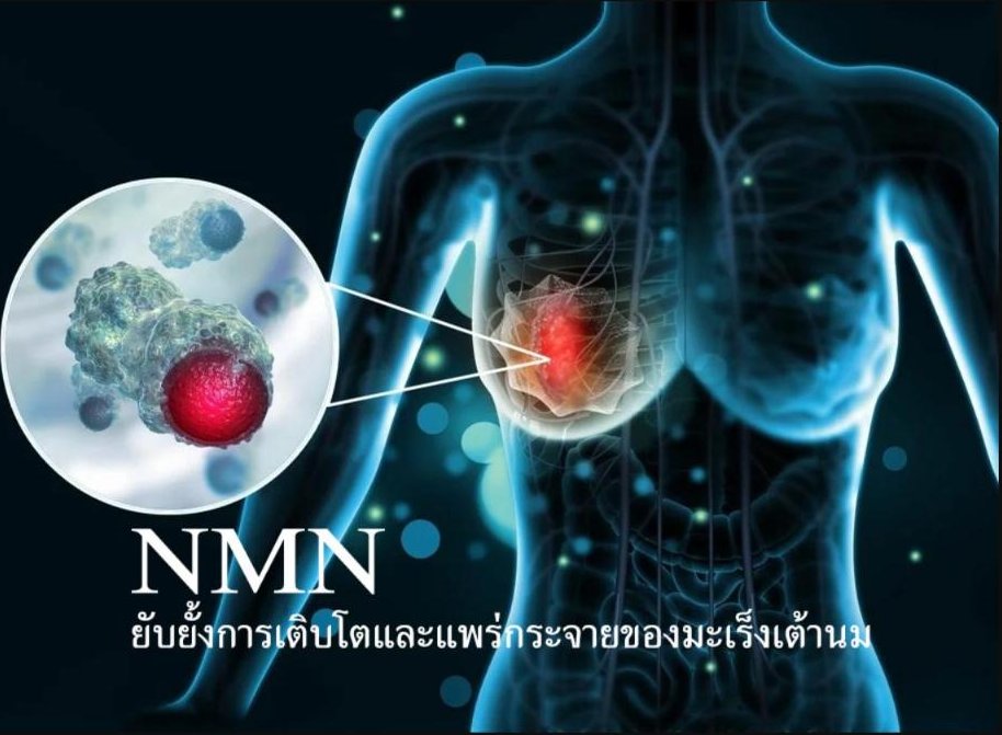 NMN ยับยั้งการเติบโตและแพร่กระจายของมะเร็งเต้านม